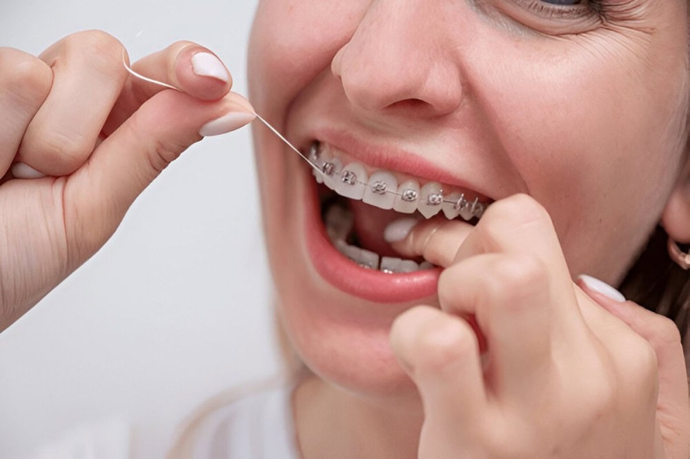 How Do Dental Braces Work
