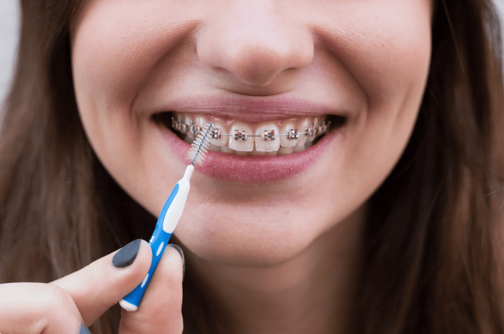 Wear Dental Braces?
