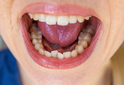 Sleep Apnea in Baton Rouge?